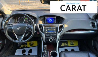 Acura TLX 2015