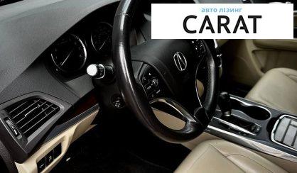 Acura MDX 2015